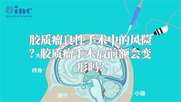 胶质瘤良性手术中的风险？胶质瘤手术后前额会变形吗？