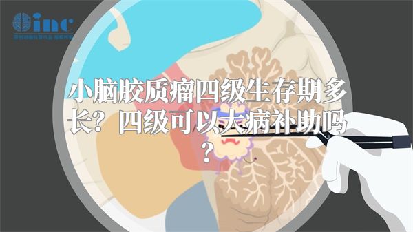 小脑胶质瘤四级生存期多长？四级可以大病补助吗？