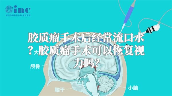 胶质瘤手术后经常流口水？胶质瘤手术可以恢复视力吗？