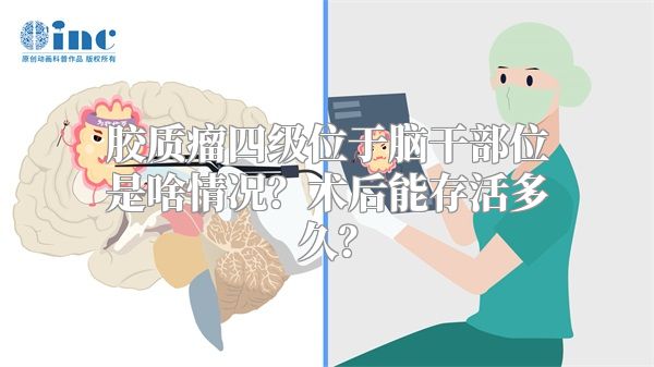 胶质瘤四级位于脑干部位是啥情况？术后能存活多久？