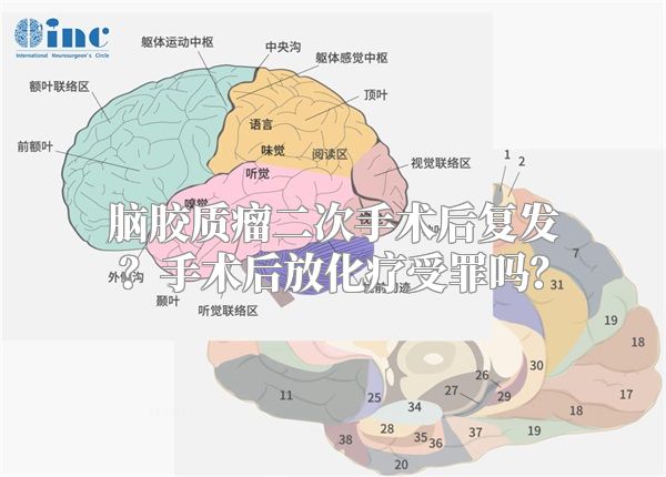 脑胶质瘤二次手术后复发？手术后放化疗受罪吗？