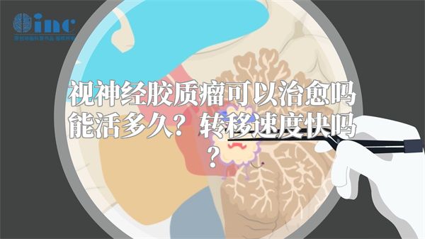 视神经胶质瘤可以治愈吗能活多久？转移速度快吗？