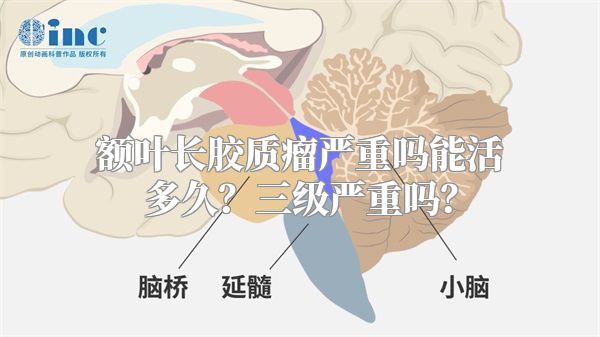 额叶长胶质瘤严重吗能活多久？三级严重吗？