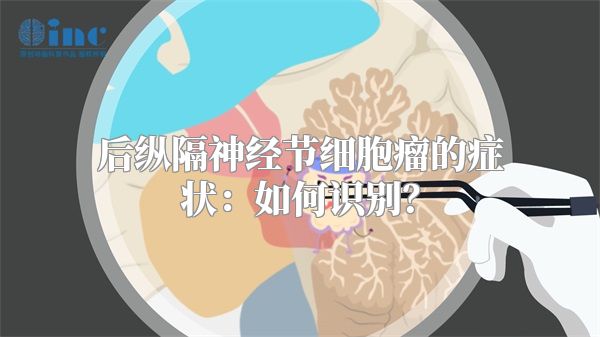 后纵隔神经节细胞瘤的症状：如何识别？