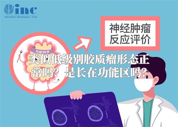 类似低级别胶质瘤形态正常吗？是长在功能区吗？