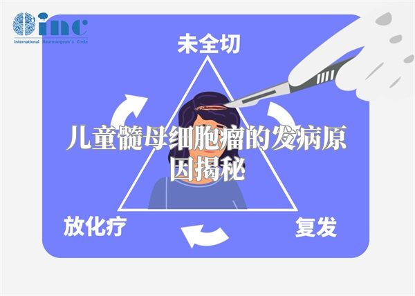 儿童髓母细胞瘤的发病原因揭秘