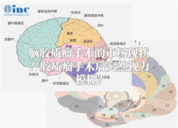 脑胶质瘤手术的市场现状？胶质瘤手术后突然视力模糊？