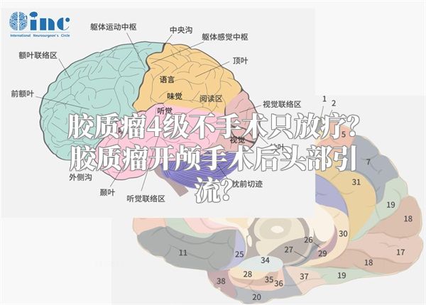 胶质瘤4级不手术只放疗？胶质瘤开颅手术后头部引流？