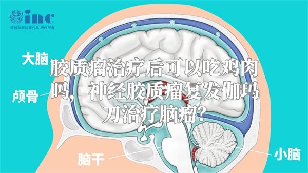 胶质瘤治疗后可以吃鸡肉吗，神经胶质瘤复发伽玛刀治疗脑瘤？