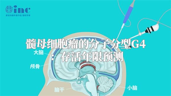 髓母细胞瘤的分子分型G4：存活年限预测