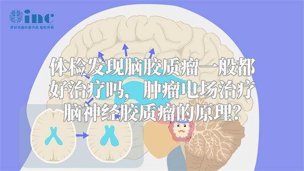 体检发现脑胶质瘤一般都好治疗吗，肿瘤电场治疗脑神经胶质瘤的原理？