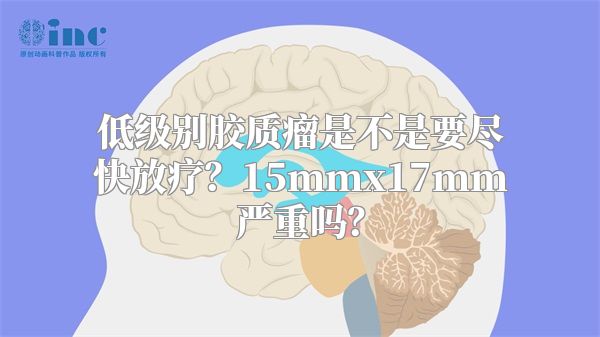 低级别胶质瘤是不是要尽快放疗？15mmx17mm严重吗？