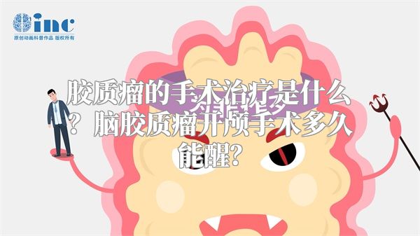 胶质瘤的手术治疗是什么？脑胶质瘤开颅手术多久能醒？