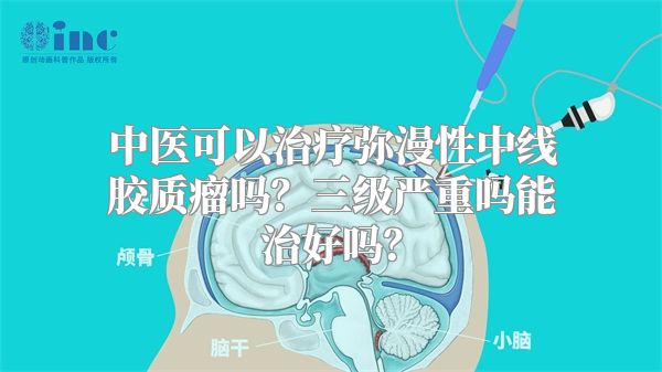 中医可以治疗弥漫性中线胶质瘤吗？三级严重吗能治好吗？