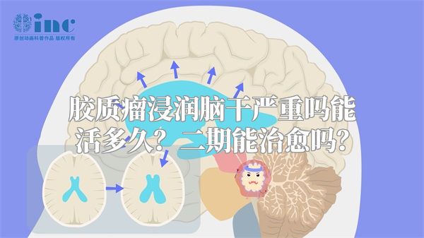 胶质瘤浸润脑干严重吗能活多久？二期能治愈吗？