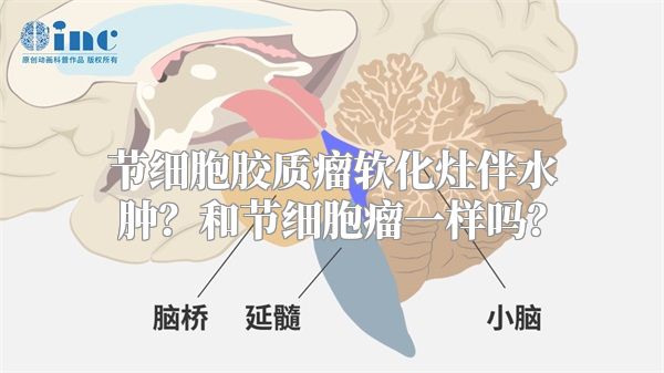 节细胞胶质瘤软化灶伴水肿？和节细胞瘤一样吗？