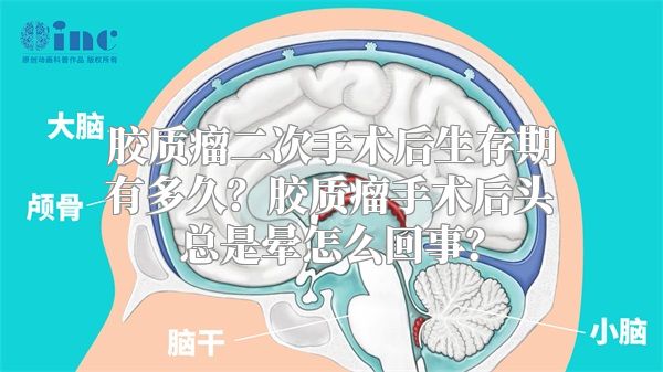 胶质瘤二次手术后生存期有多久？胶质瘤手术后头总是晕怎么回事？