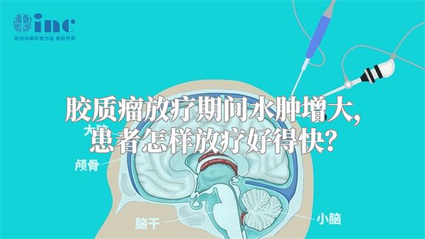 胶质瘤放疗期间水肿增大，患者怎样放疗好得快？