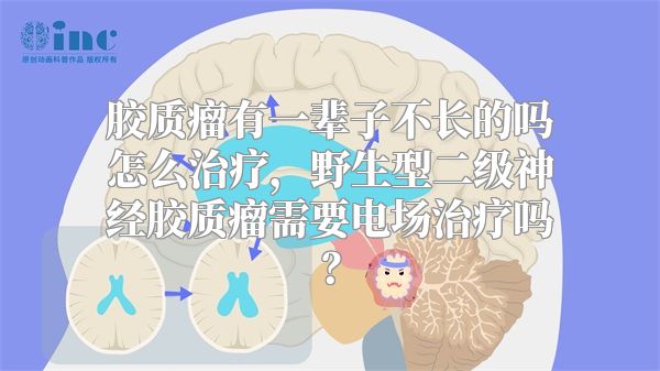 胶质瘤有一辈子不长的吗怎么治疗，野生型二级神经胶质瘤需要电场治疗吗？