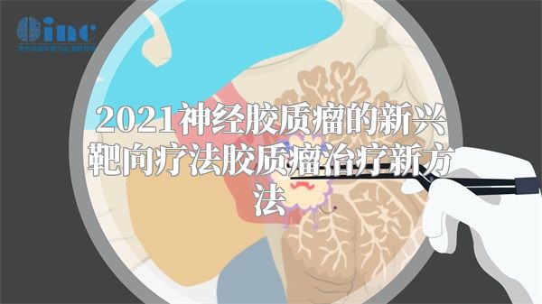 2021神经胶质瘤的新兴靶向疗法胶质瘤治疗新方法