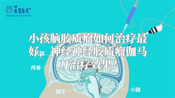 小孩脑胶质瘤如何治疗最好，神经神经胶质瘤伽马刀治疗效果？