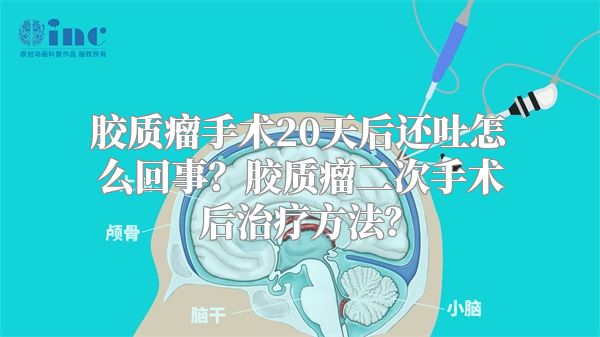 胶质瘤手术20天后还吐怎么回事？胶质瘤二次手术后治疗方法？