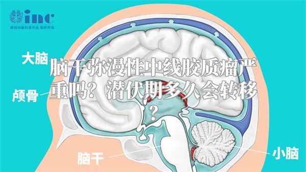 脑干弥漫性中线胶质瘤严重吗？潜伏期多久会转移？