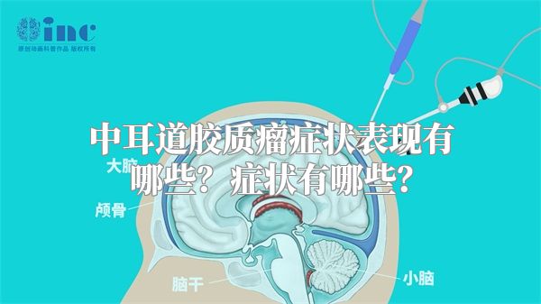 中耳道胶质瘤症状表现有哪些？症状有哪些？