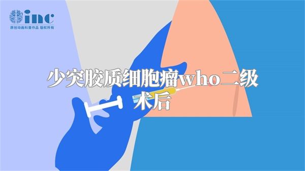 少突胶质细胞瘤who二级术后