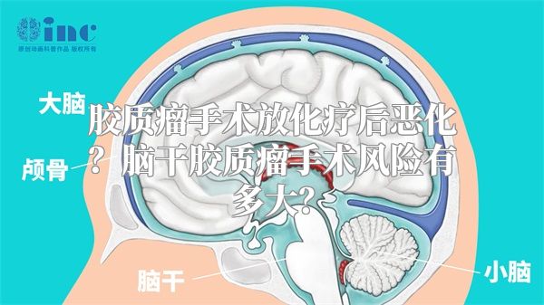 胶质瘤手术放化疗后恶化？脑干胶质瘤手术风险有多大？