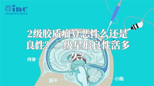 2级胶质瘤算恶性么还是良性？二级星形良性活多久？