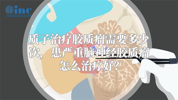 质子治疗胶质瘤需要多少次，患严重脑神经胶质瘤怎么治疗好？