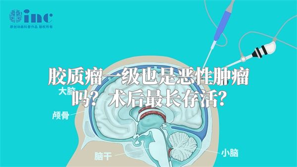 胶质瘤一级也是恶性肿瘤吗？术后最长存活？