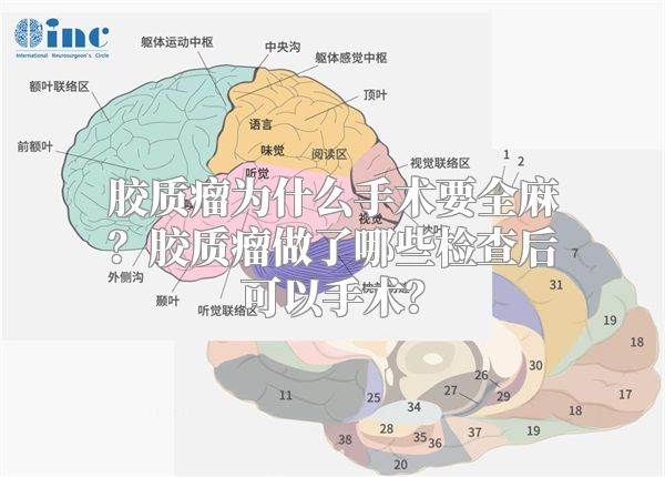 胶质瘤为什么手术要全麻？胶质瘤做了哪些检查后可以手术？