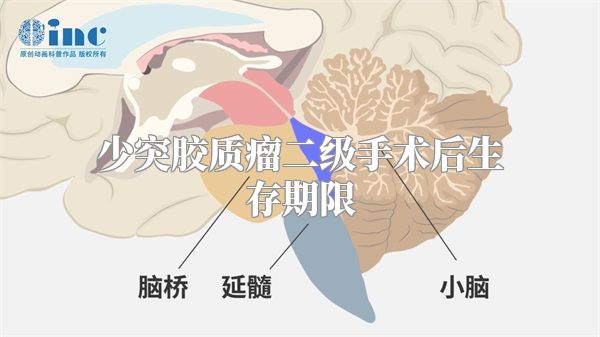 少突胶质瘤二级手术后生存期限