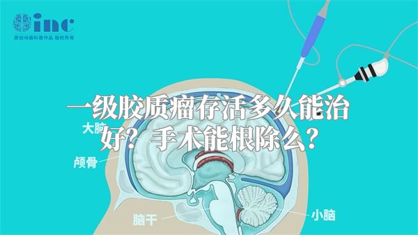 一级胶质瘤存活多久能治好？手术能根除么？