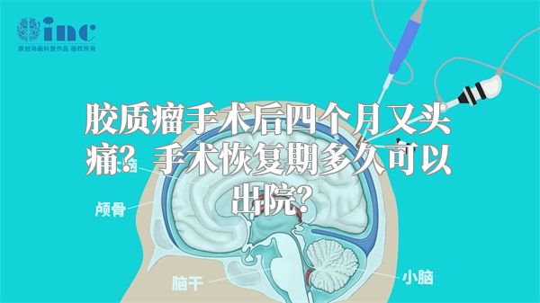 胶质瘤手术后四个月又头痛？手术恢复期多久可以出院？