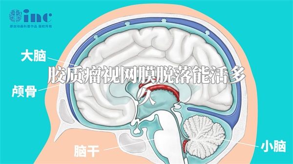 胶质瘤视网膜脱落能活多久