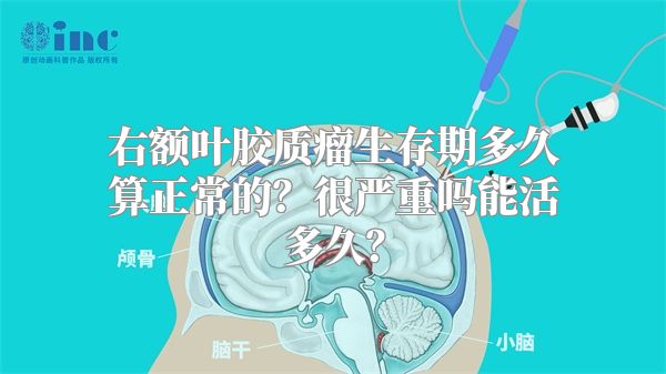 右额叶胶质瘤生存期多久算正常的？很严重吗能活多久？