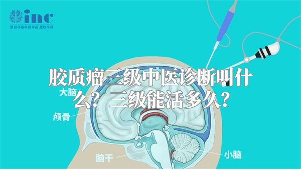 胶质瘤三级中医诊断叫什么？三级能活多久？