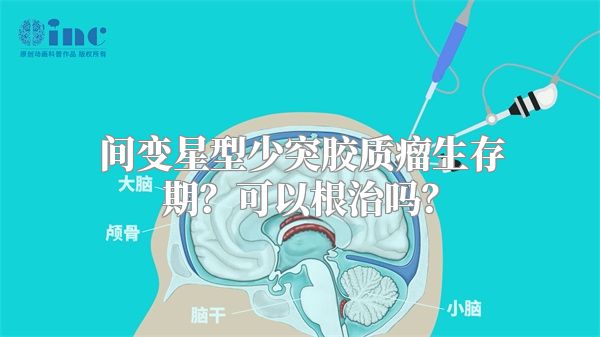 间变星型少突胶质瘤生存期？可以根治吗？