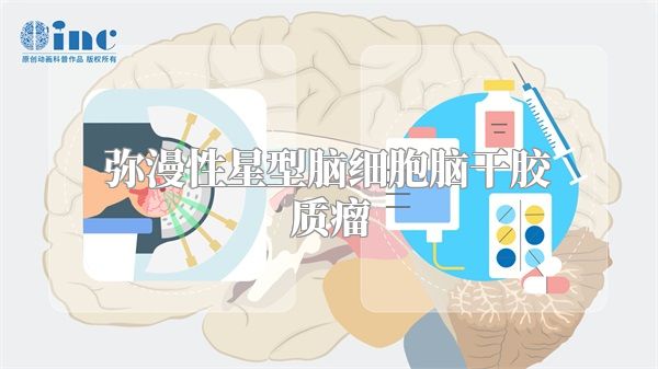 弥漫性星型脑细胞脑干胶质瘤