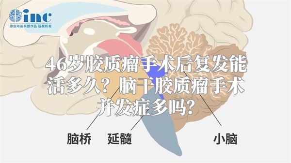 46岁胶质瘤手术后复发能活多久？脑干胶质瘤手术并发症多吗？