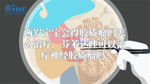 两岁宝宝会得胶质瘤吗怎么治疗，芬苯达唑可以治疗神经胶质瘤吗？