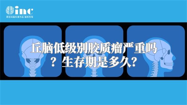 丘脑低级别胶质瘤严重吗？生存期是多久？