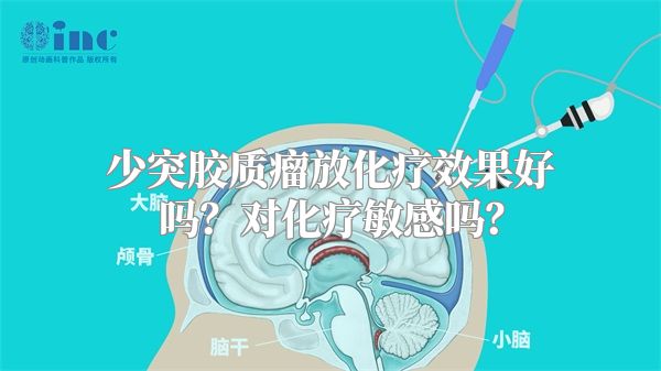 少突胶质瘤放化疗效果好吗？对化疗敏感吗？