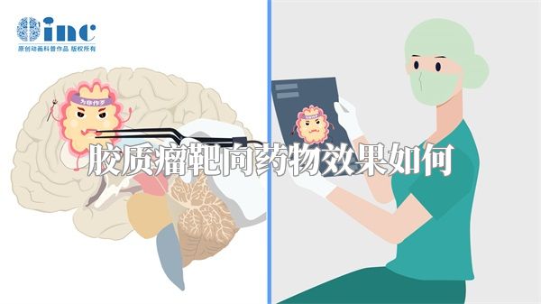 胶质瘤靶向药物效果如何