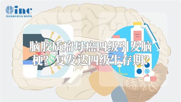 脑胶质瘤母癌四级引发脑梗？复发达四级生存期？