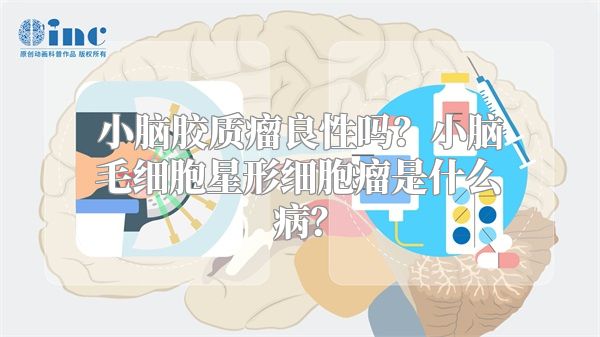 小脑胶质瘤良性吗？小脑毛细胞星形细胞瘤是什么病？