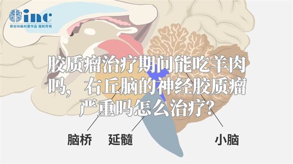 胶质瘤治疗期间能吃羊肉吗，右丘脑的神经胶质瘤严重吗怎么治疗？